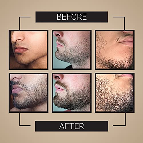 Product Image: Beard Growth Kit – Hair Growth & Hair Serum