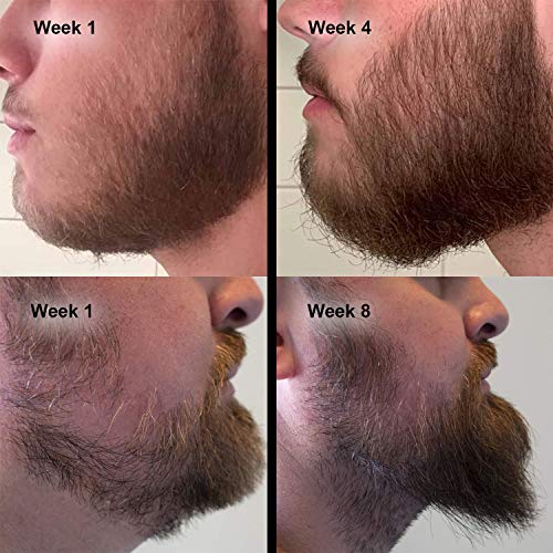 Product Image: Beard Growth Kit – Hair Growth & Hair Serum