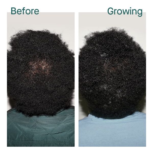 Product Image and Link for Ukuaji Intensive Hair Growth Elixir | By Vanda Salon Hair Loss Solutions